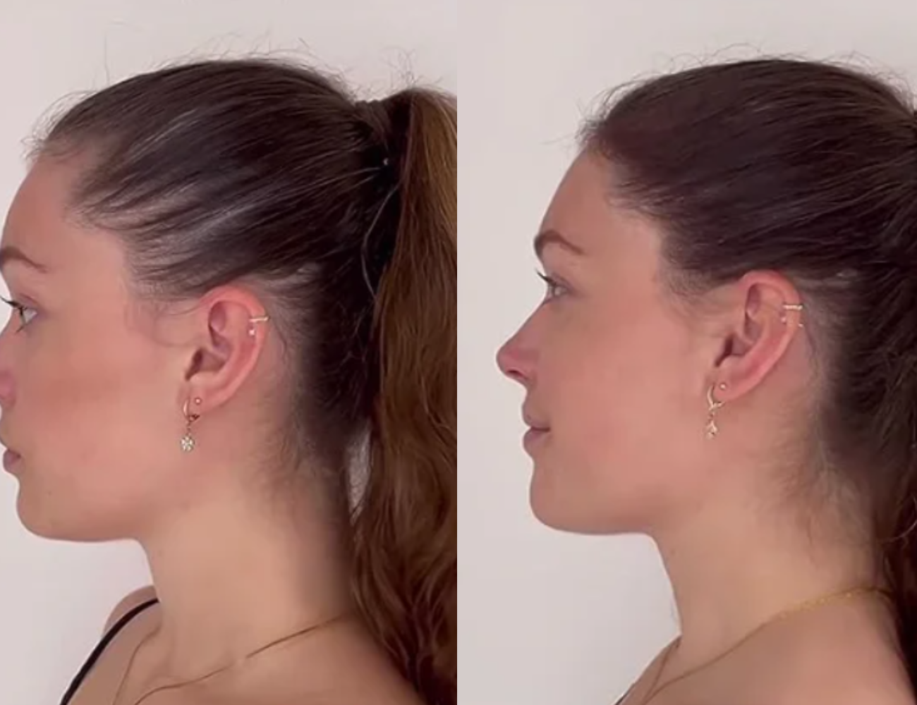 Lustrao Hair Growth Trio Combo