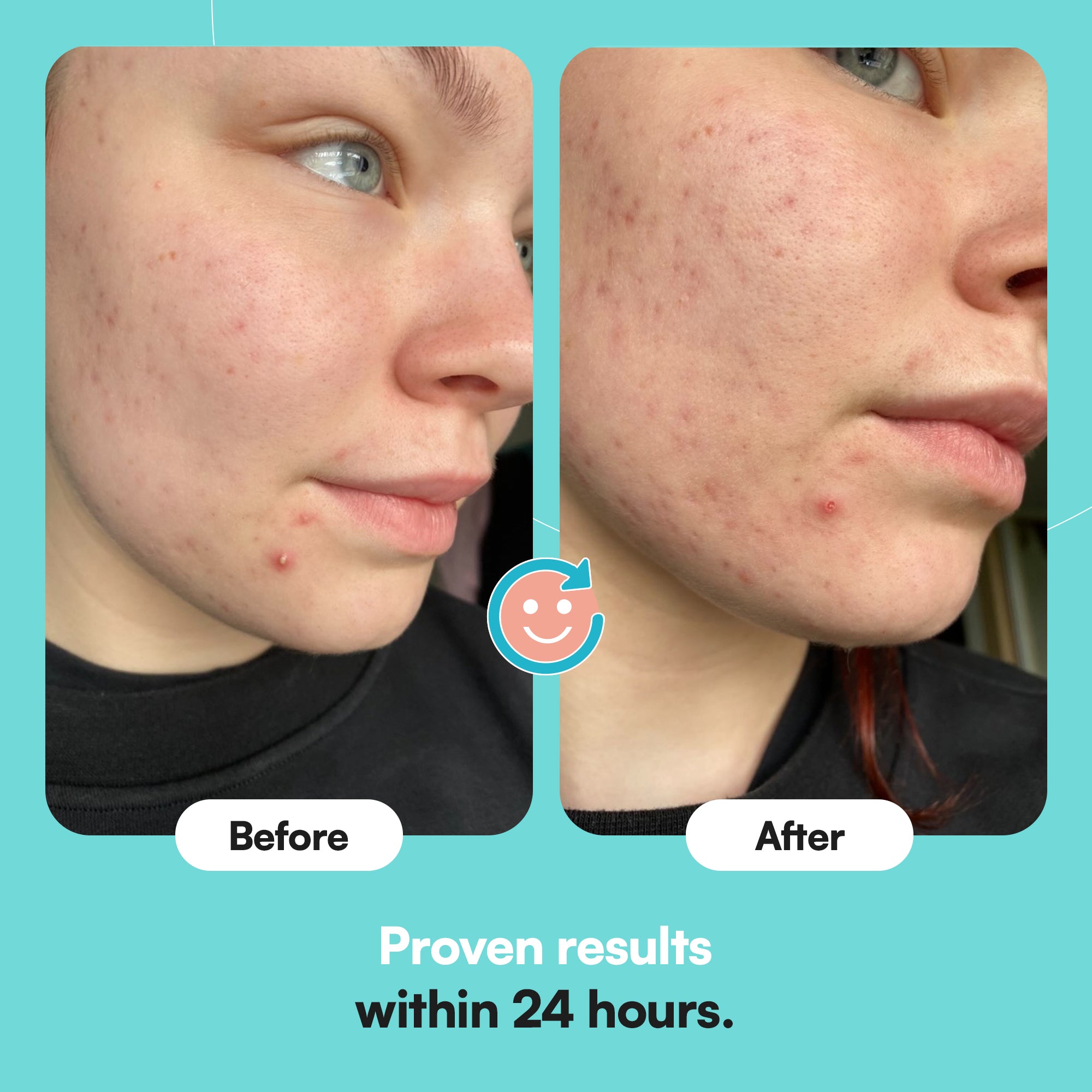 Skin Choice Breakout Patch - Classic & Nose Duo