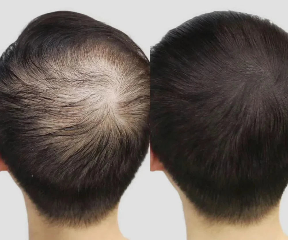 Lustrao Hair Growth Trio Combo